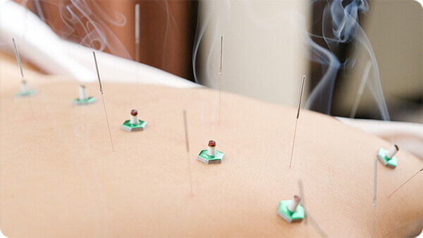 はり師・きゅう師の資格をとるには？